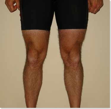 legs before and after running